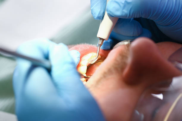 Best Emergency TMJ Treatment in Upland, PA