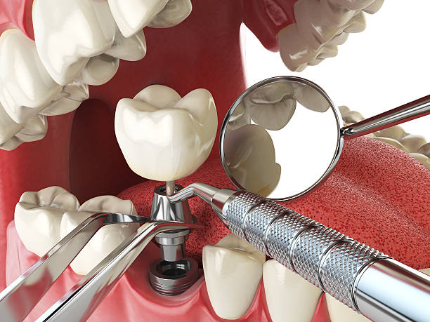 Best Emergency Gum Treatment in Upland, PA